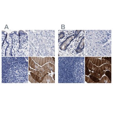 Anti-KLHL41 antibody produced in rabbit Prestige Antibodies&#174; Powered by Atlas Antibodies, affinity isolated antibody, buffered aqueous glycerol solution, Ab3