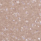 Anti-TM6SF2 antibody produced in rabbit Prestige Antibodies® Powered by Atlas Antibodies, affinity isolated antibody, buffered aqueous glycerol solution