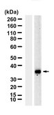 Anti-IL-1β Antibody, clone 1H20-H2 ZooMAb® Rabbit Monoclonal recombinant, expressed in HEK 293 cells