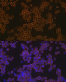 Anti-PLC gamma 2 (PLCG2) Antibody, clone 7I1C9, Rabbit Monoclonal