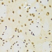 Anti-SUZ12 antibody produced in rabbit