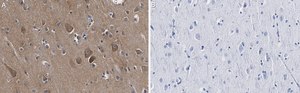 Anti-Catenin-α 2 Antibody, clone 3F7 ZooMAb® Rabbit Monoclonal recombinant, expressed in HEK 293 cells