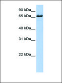 Anti-ZDHHC17 (AB1) antibody produced in rabbit affinity isolated antibody