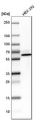Anti-PNKP antibody produced in rabbit Prestige Antibodies® Powered by Atlas Antibodies, affinity isolated antibody, buffered aqueous glycerol solution