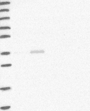 Anti-HAO2 antibody produced in rabbit Prestige Antibodies&#174; Powered by Atlas Antibodies, affinity isolated antibody, buffered aqueous glycerol solution