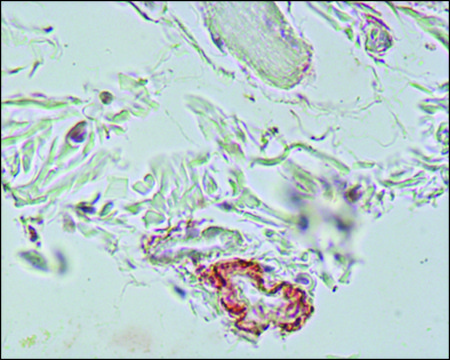 Monoclonal Anti-Elastin antibody produced in mouse clone BA-4, ascites fluid