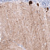 Monoclonal Anti-CALB1 antibody produced in mouse Prestige Antibodies® Powered by Atlas Antibodies, clone CL15059, purified antibody (Protein A)