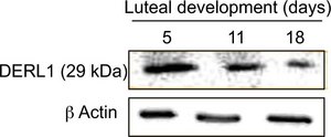 Anti-Derlin-1 antibody produced in rabbit ~1 mg/mL, affinity isolated antibody, buffered aqueous solution