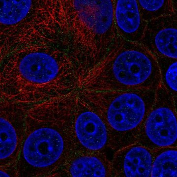 Anti-EPCAM antibody produced in rabbit Prestige Antibodies&#174; Powered by Atlas Antibodies, affinity isolated antibody