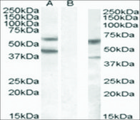 Anti-DGAT2 antibody produced in goat affinity isolated antibody, buffered aqueous solution