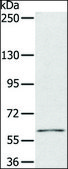 Anti-PDP1 antibody produced in rabbit affinity isolated antibody