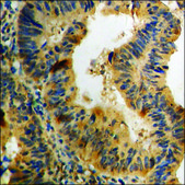 Anti-phospho-AKT1 (pThr308) antibody produced in rabbit affinity isolated antibody