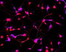 Human Striatal Medium Spiny GABAergic Neurons Human iPSC line, Fully differentiated, Healthy Male Control (no known neurological disorders), Cryopreserved