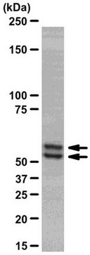 Anti-Smad2/3 Antibody, clone C4T, rabbit monoclonal culture supernatant, clone C4T, from rabbit