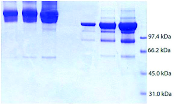 Alpha 2 Macroglobulin from human plasma &#8805;95% (SDS-PAGE)