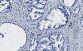 Anti-CHD-8 Antibody, clone 1H9 ZooMAb® Rabbit Monoclonal recombinant, expressed in HEK 293 cells