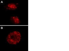 LentiBrite RFP-Rad51 Lentiviral Biosensor