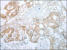 Anti-LYPLA2 affinity isolated antibody