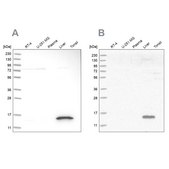 Anti-RIDA antibody produced in rabbit Prestige Antibodies® Powered by Atlas Antibodies, affinity isolated antibody, buffered aqueous glycerol solution, Ab2