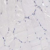 Anti-SLITRK4 antibody produced in rabbit Prestige Antibodies® Powered by Atlas Antibodies, affinity isolated antibody