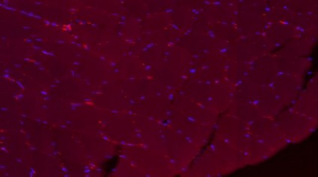 Anti-Dystrophin Antibody, clone 2C6 (MANDYS106), Alexa Fluor&#8482; 555 Conjugate clone 2C6 (MANDYS106), from mouse, ALEXA FLUOR&#8482; 555