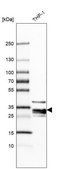 Anti-RNASET2 antibody produced in rabbit Prestige Antibodies® Powered by Atlas Antibodies, affinity isolated antibody, buffered aqueous glycerol solution