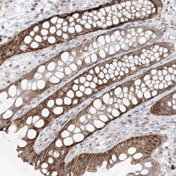 Anti-UBE2E2 antibody produced in rabbit Prestige Antibodies&#174; Powered by Atlas Antibodies, affinity isolated antibody, buffered aqueous glycerol solution