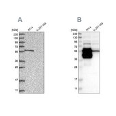 Anti-BAIAP2L1 antibody produced in rabbit Prestige Antibodies® Powered by Atlas Antibodies, affinity isolated antibody, buffered aqueous glycerol solution