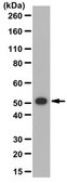 Anti-Tryptophan hydroxylase 1/TPH1 Antibody from rabbit, purified by affinity chromatography