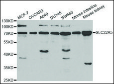 Anti-SLC22A5 antibody produced in rabbit affinity isolated antibody