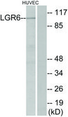 Anti-LGR6 antibody produced in rabbit affinity isolated antibody