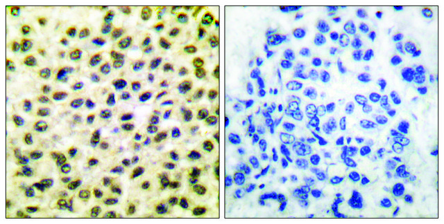 Anti-FOS antibody produced in rabbit affinity isolated antibody