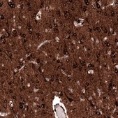 Anti-SLC10A5 antibody produced in rabbit Prestige Antibodies® Powered by Atlas Antibodies, affinity isolated antibody, buffered aqueous glycerol solution