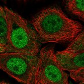 Anti-RPP25L antibody produced in rabbit Prestige Antibodies® Powered by Atlas Antibodies, affinity isolated antibody, buffered aqueous glycerol solution