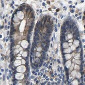 Anti-FHIT antibody produced in rabbit Prestige Antibodies® Powered by Atlas Antibodies, affinity isolated antibody, buffered aqueous glycerol solution