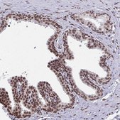 Anti-HOXA9 antibody produced in rabbit Prestige Antibodies® Powered by Atlas Antibodies, affinity isolated antibody, buffered aqueous glycerol solution