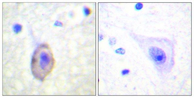 Anti-VEGFR1 antibody produced in rabbit affinity isolated antibody