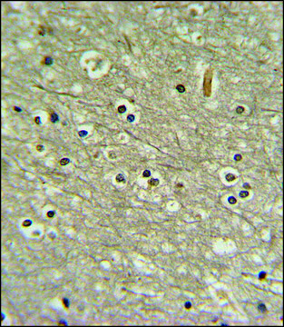 ANTI-WDR82 (N-TERM) antibody produced in rabbit IgG fraction of antiserum, buffered aqueous solution