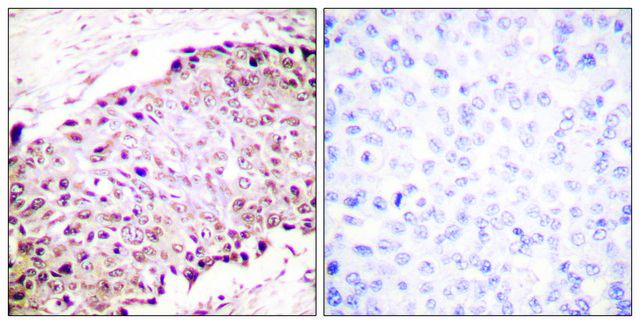 Anti-SUMO1, N-Terminal antibody produced in rabbit affinity isolated antibody