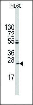 Anti-UBTD1 (C-term Q173) antibody produced in rabbit Ig fraction of antiserum, buffered aqueous solution