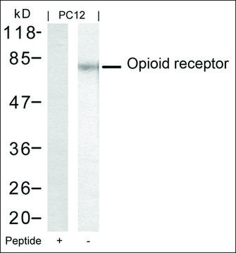 Anti-OPRM1 (Ab-375) antibody produced in rabbit affinity isolated antibody