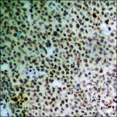 Anti-phospho-PTPRA (pTyr798) antibody produced in rabbit affinity isolated antibody