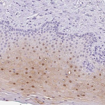 Anti-SERPINB4 antibody produced in rabbit Prestige Antibodies&#174; Powered by Atlas Antibodies, affinity isolated antibody, buffered aqueous glycerol solution