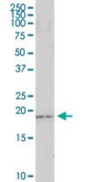 Anti-CARD16 antibody produced in rabbit purified immunoglobulin, buffered aqueous solution