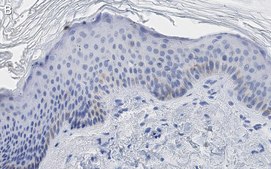 Anti-Cytokeratin-14 Antibody, clone 1D15 ZooMAb® Rabbit Monoclonal recombinant, expressed in HEK 293 cells