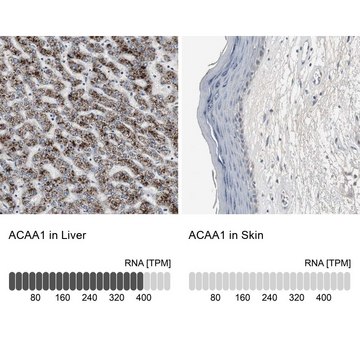 Anti-ACAA1 antibody produced in rabbit Ab1, Prestige Antibodies&#174; Powered by Atlas Antibodies, affinity isolated antibody, buffered aqueous glycerol solution