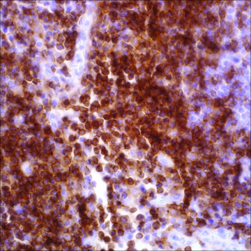 CD4 (EP204) Rabbit Monoclonal Primary Antibody