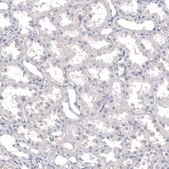 Monoclonal Anti-INSM1 antibody produced in mouse Prestige Antibodies® Powered by Atlas Antibodies, clone CL11630, purified immunoglobulin, buffered aqueous glycerol solution