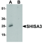 Anti-SHISA3 antibody produced in rabbit affinity isolated antibody, buffered aqueous solution