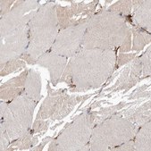 抗-SEMA3E 兔抗 Prestige Antibodies® Powered by Atlas Antibodies, affinity isolated antibody, buffered aqueous glycerol solution